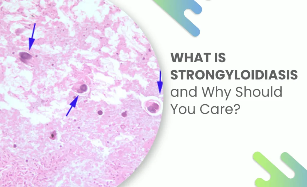 Microscopic view of Strongyloides parasite in tissue sample