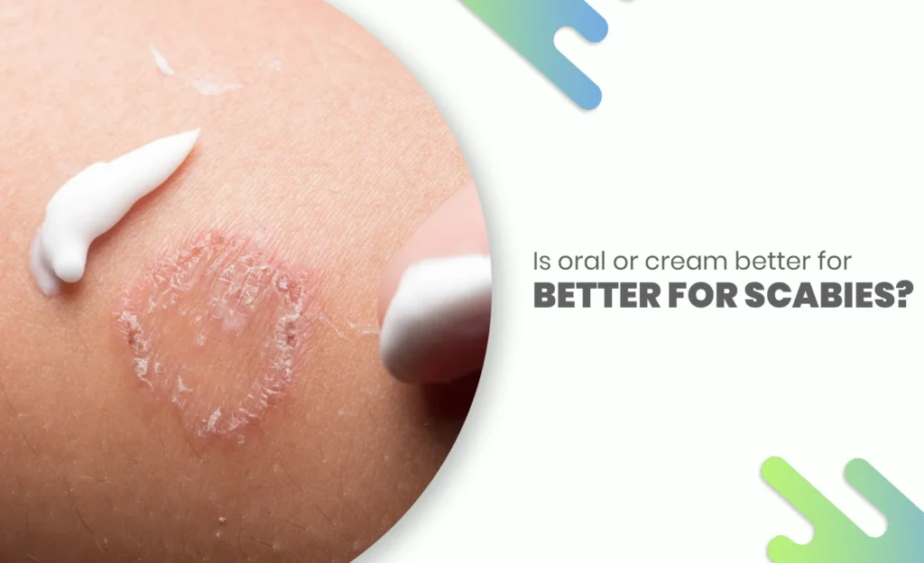 Close-up of a skin rash with cream applied, questioning if oral medication or topical cream is better for treating scabies.