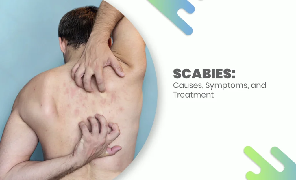 Man scratching his back due to scabies rash