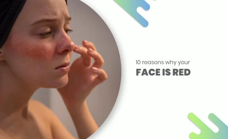 Close-up of a woman with facial redness and irritation on cheeks and nose, highlighting causes of red face.