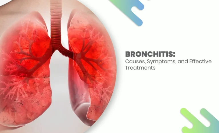 Illustration of inflamed lungs showing bronchitis with highlighted bronchial tubes – causes, symptoms, and treatments guide.