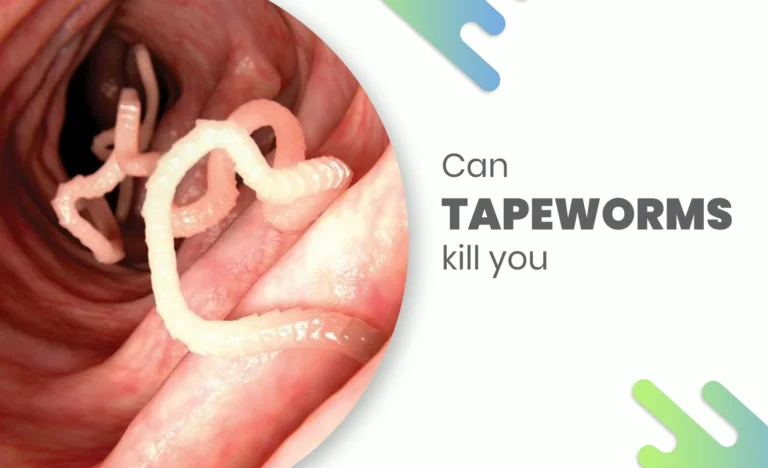 Tapeworm inside human intestine – Can tapeworms kill you