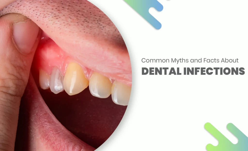 Dental infection myths and facts illustration