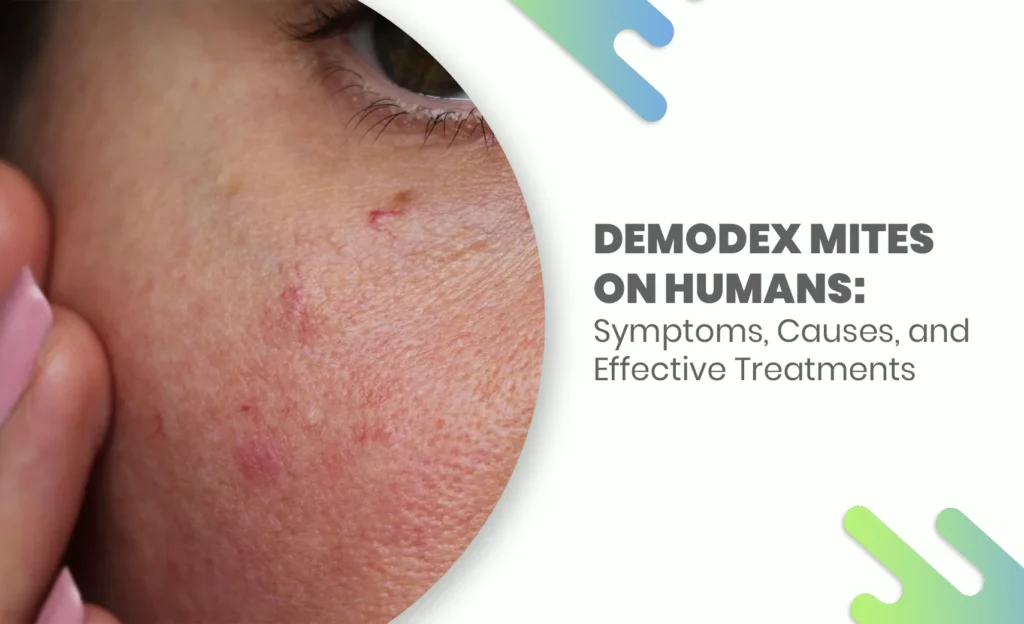 Skin irritation showing effects of Demodex Mites on Humans with blog title overlay.