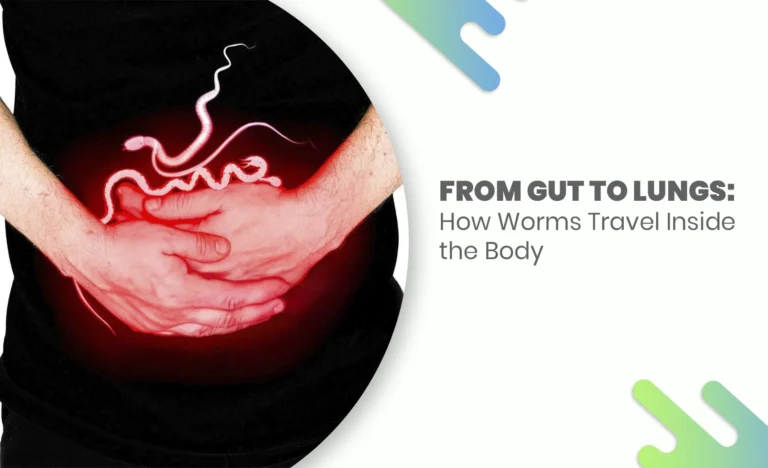 Illustration of intestinal worms inside the human body with text From Gut to Lungs : How Worms Travel Inside the Body.