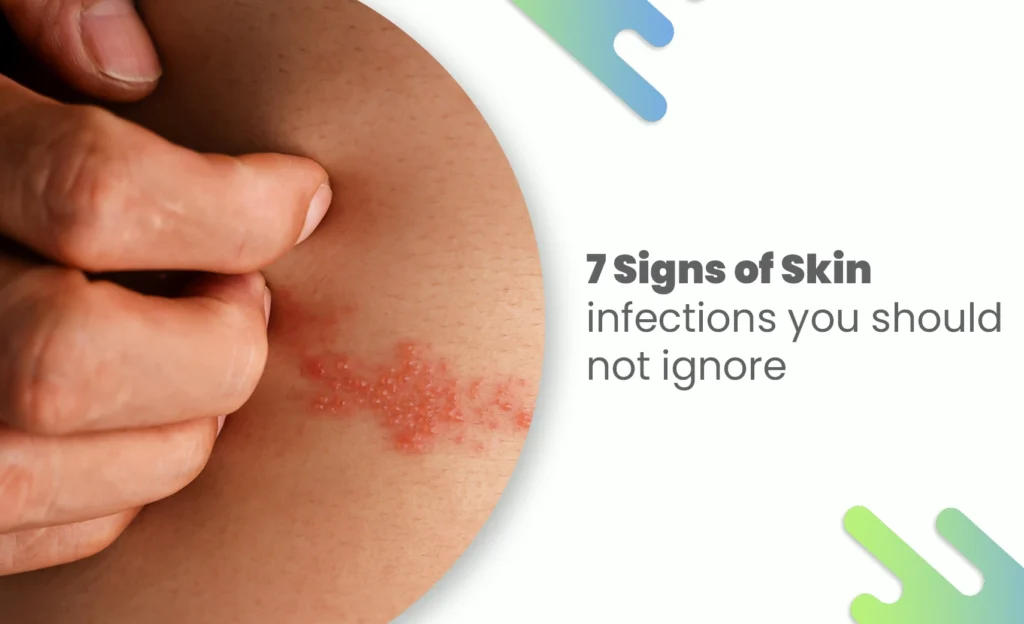 Person scratching red skin infections rash