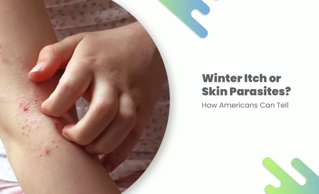 Person scratching red, irritated skin on arm, suggesting winter itch or scabies