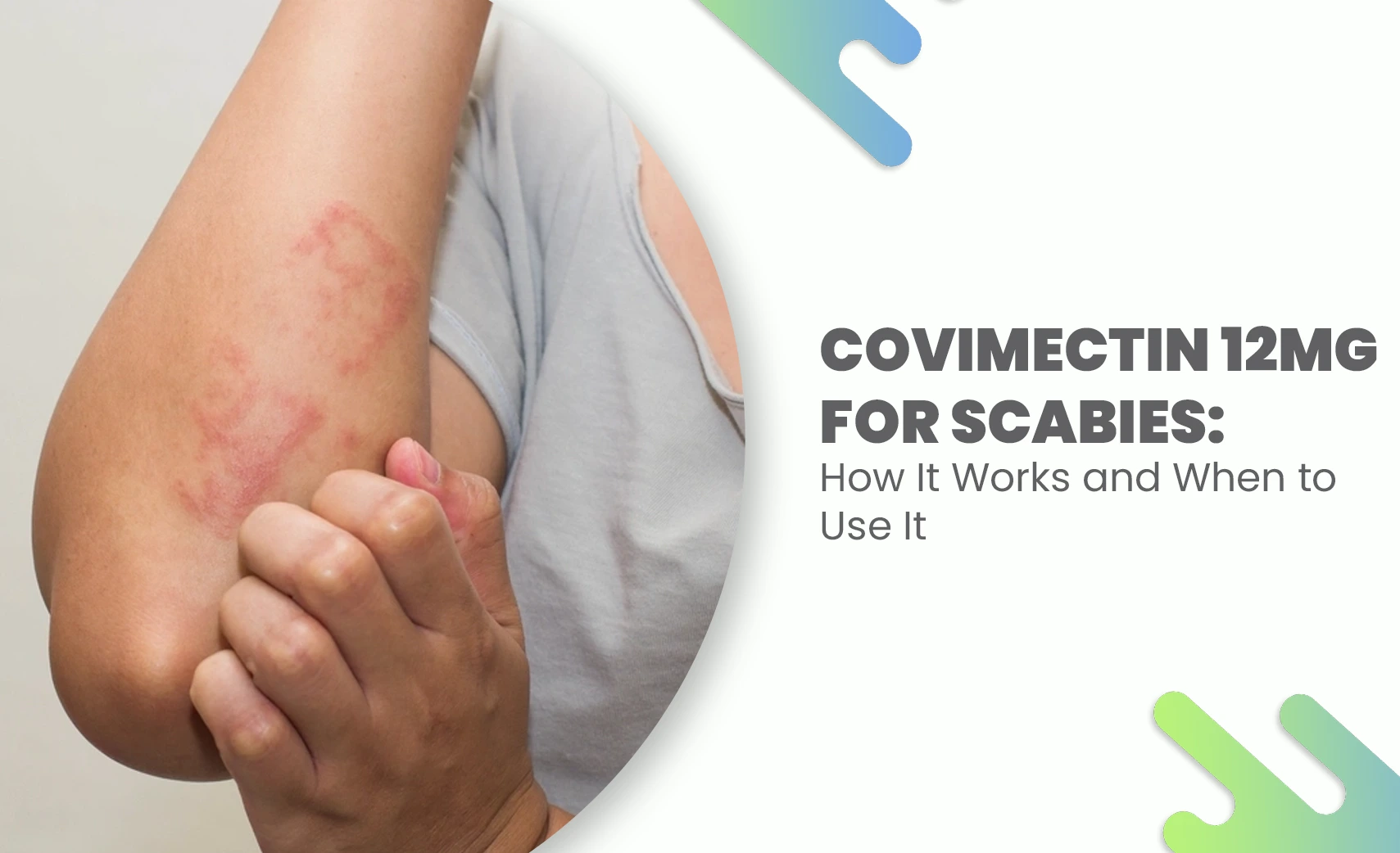 How Covimectin 12mg Treats Scabies and When to Take It