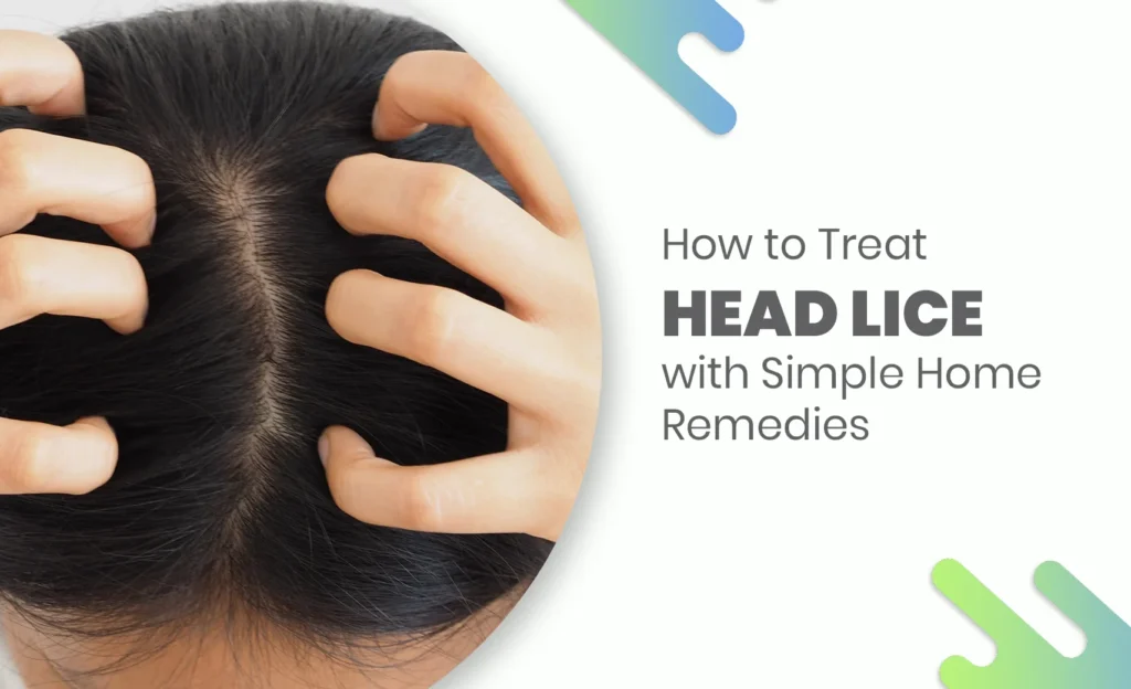 Person scratching scalp due to head lice infestation, representing home treatment for lice.