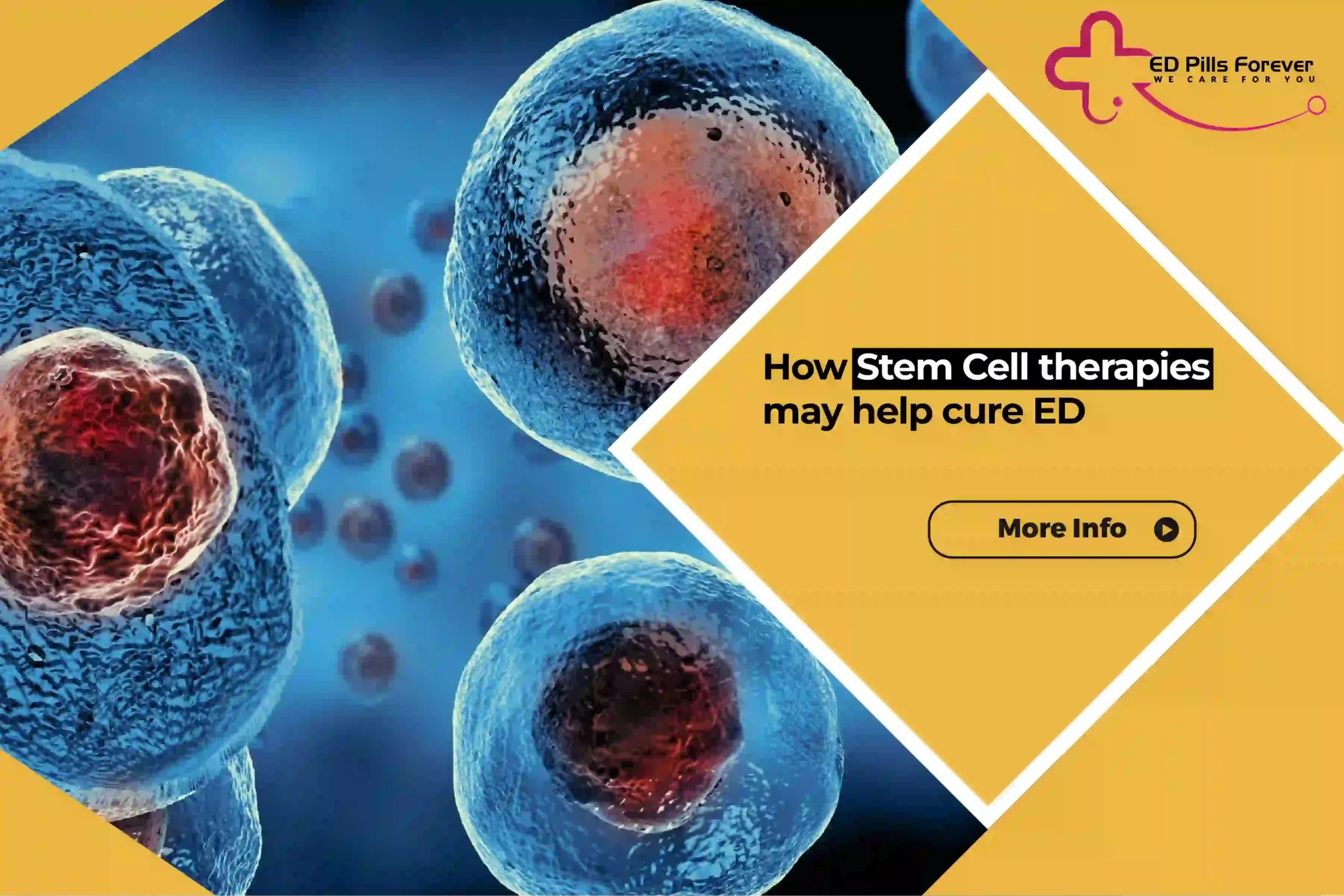 How Stem Cell therapies may help cure ED