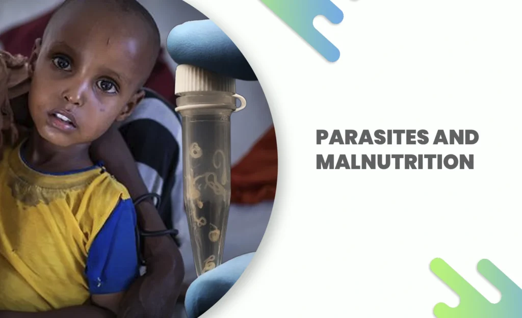Malnourished child and intestinal worms linked to parasite infection