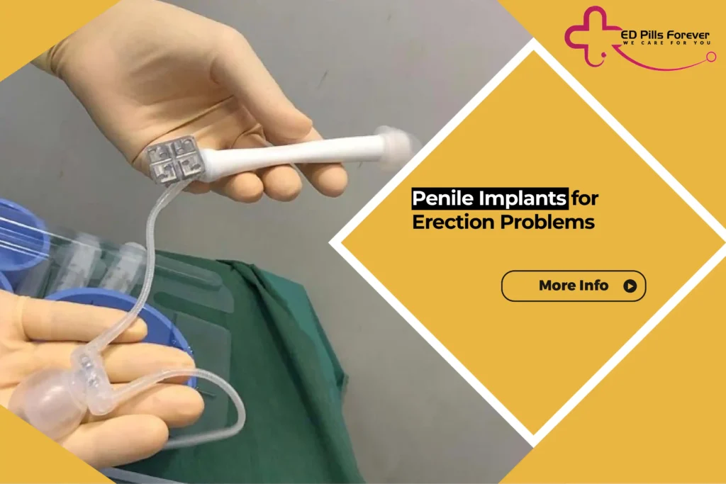 Penile Implants for Erection Problems