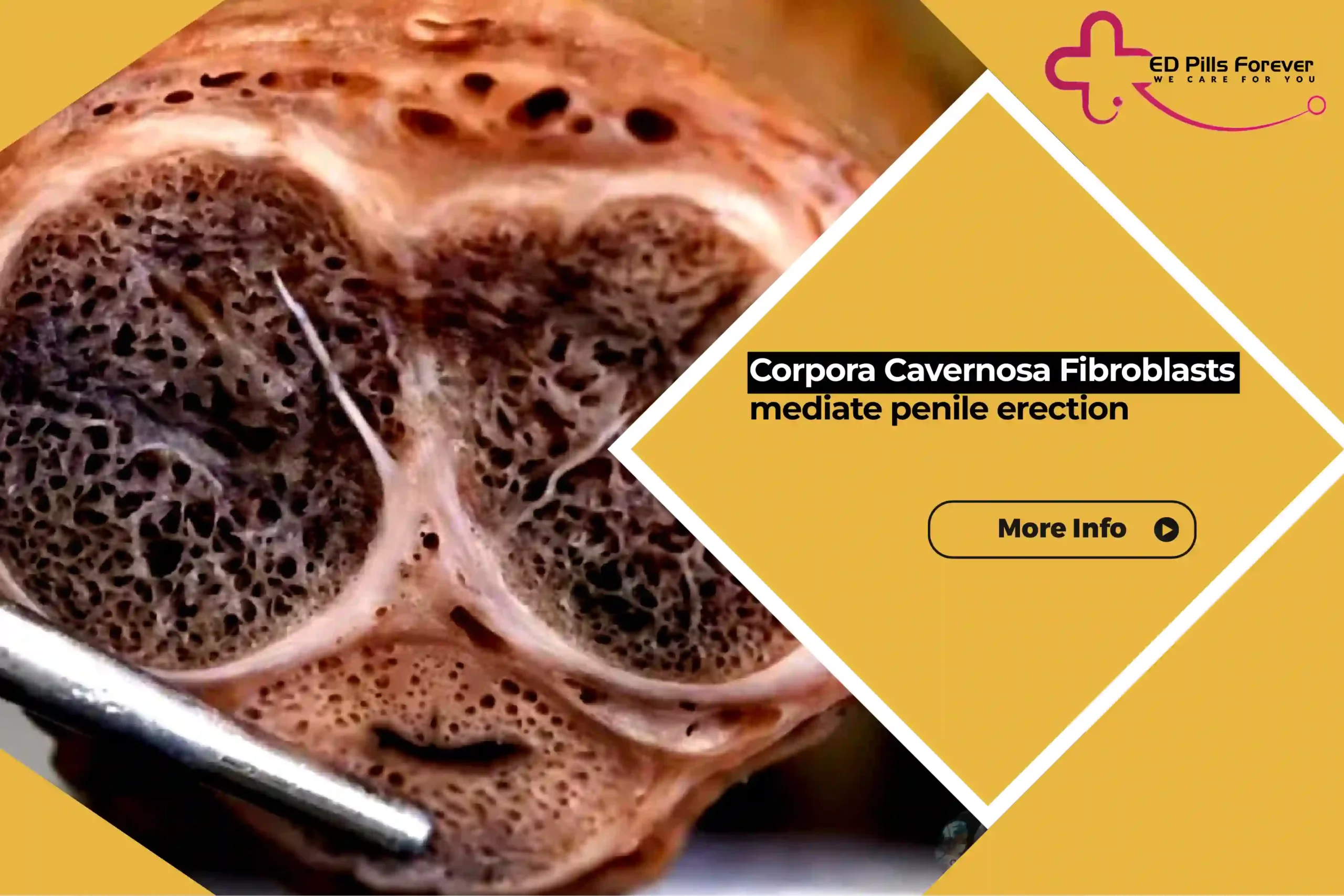 Corpora cavernosa fibroblasts mediate penile erection