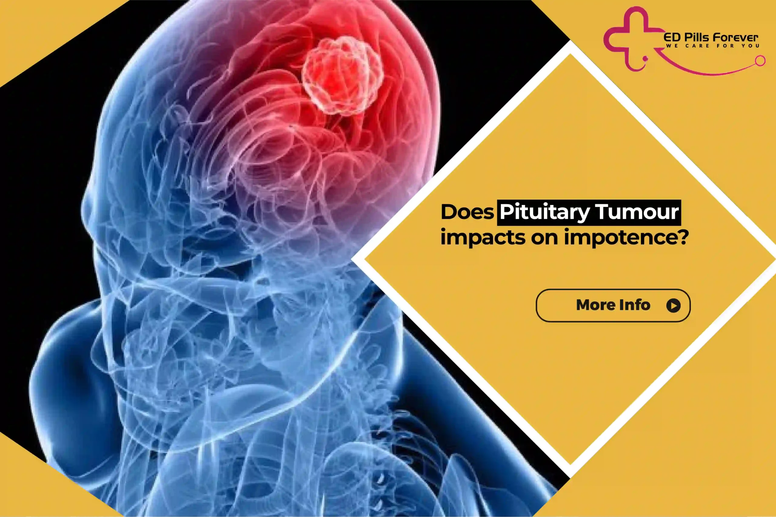 Does pituitary tumour impacts on impotence