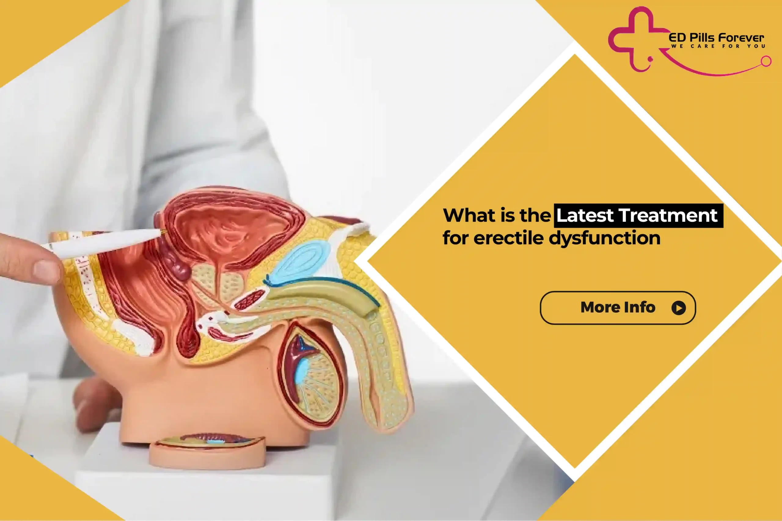 What is the latest treatment for erectile dysfunction