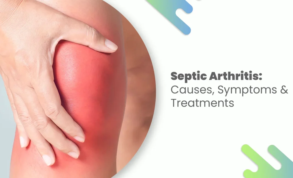 Swollen red knee showing severe inflammation from septic arthritis