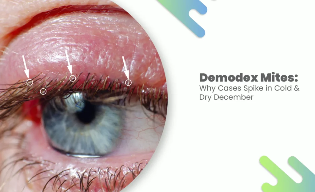 Demodex Mites affecting eyelash follicles in winter